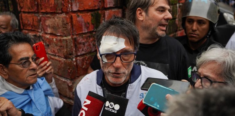 Represi&oacute;n en marcha de jubilados frente al Congreso: hieren al padre Paco Olveira y detienen a un manifestante